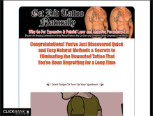 Tablet Screenshot of getridtattoo.com